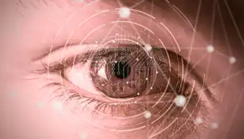 Eye On The Network Connections